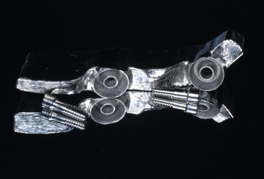 한솔치과기공소 작품 1