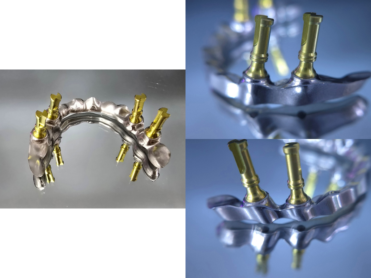 한솔치과기공소 작품 4